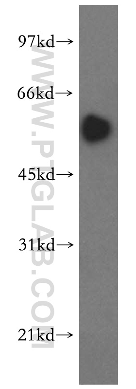 SMAD9 Polyclonal antibody