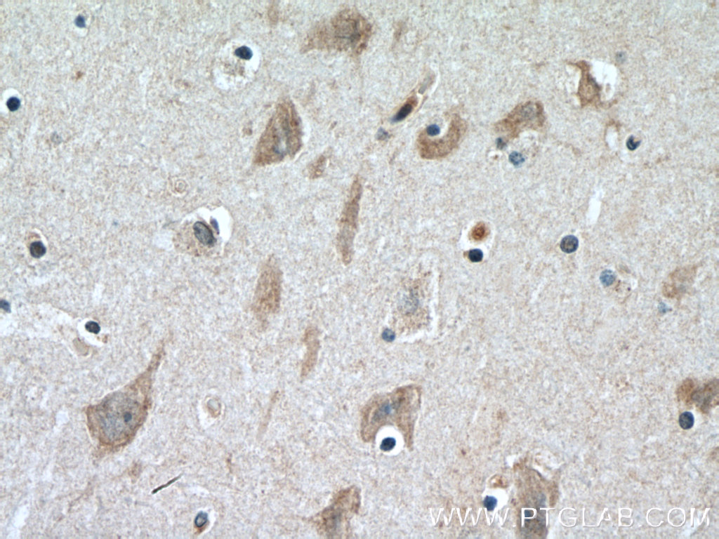 CERCAM Polyclonal antibody
