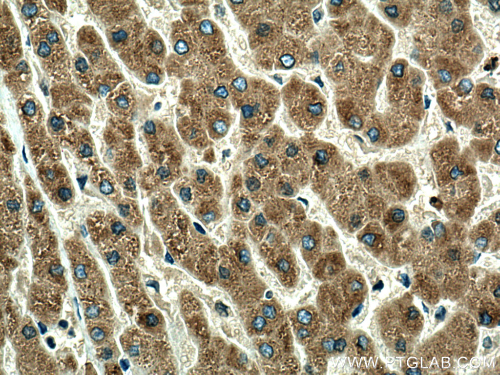 ORM1 Polyclonal antibody