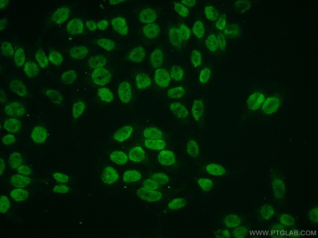 Histone H2A.z Polyclonal antibody