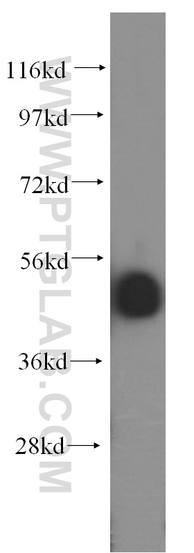 INTS12 Polyclonal antibody