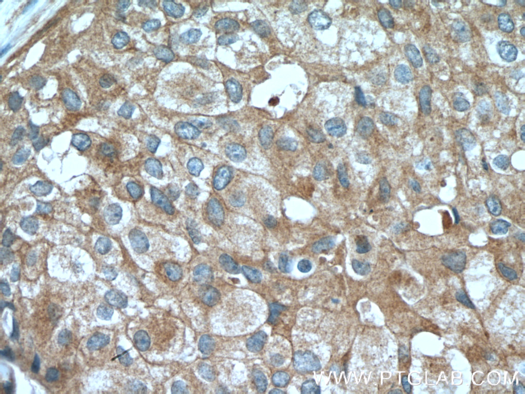Claudin 3 Polyclonal antibody