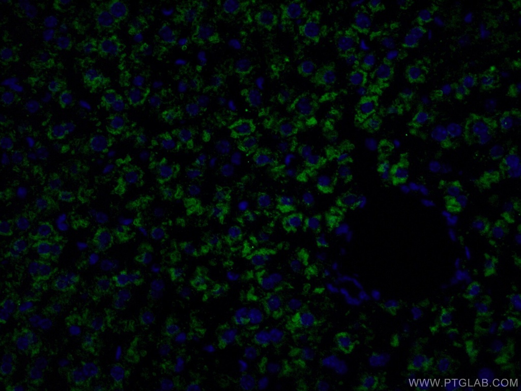 Albumin Polyclonal antibody