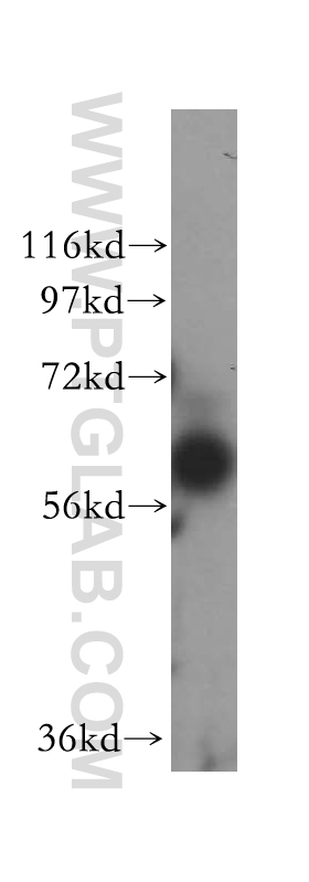 BTN2A2 Polyclonal antibody
