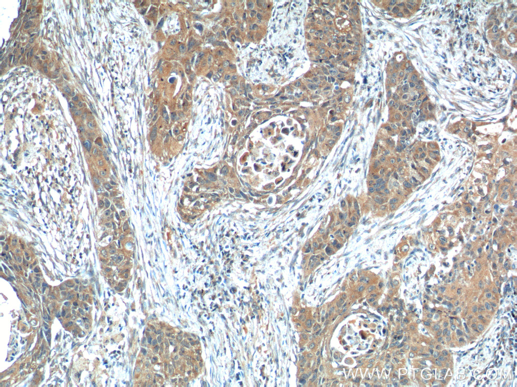 ODAM Polyclonal antibody