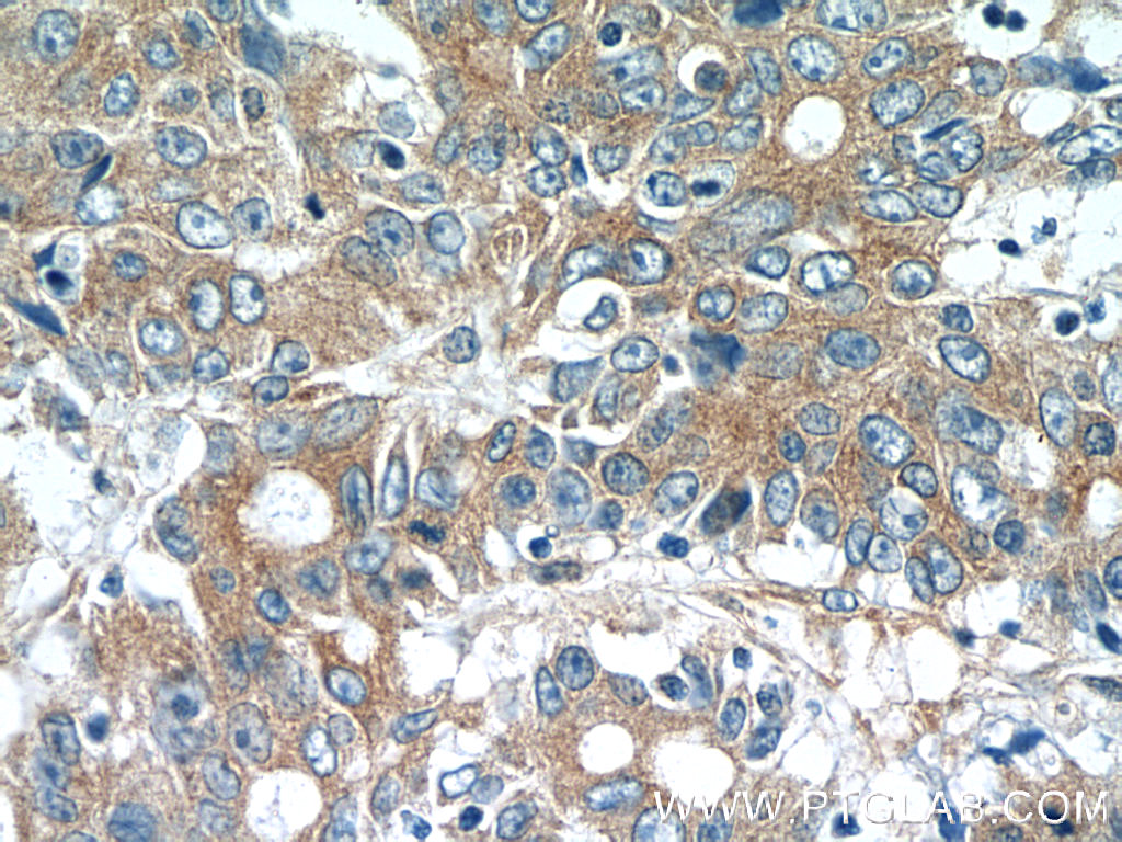 MOBKL3 Polyclonal antibody
