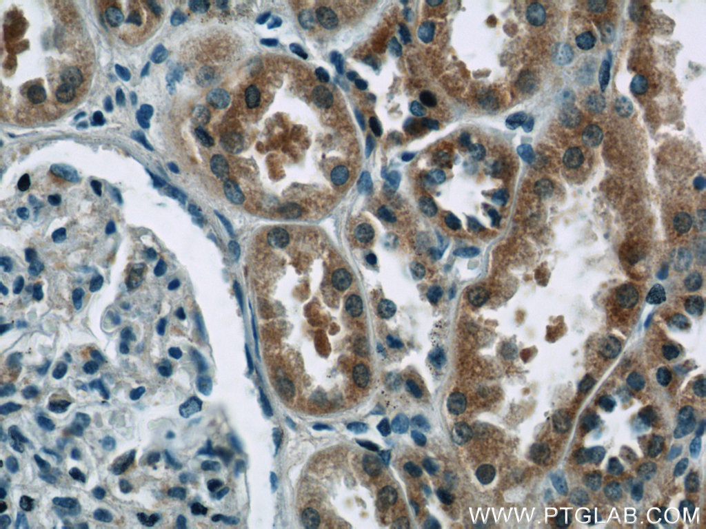 EIF1, EIF1B Polyclonal antibody