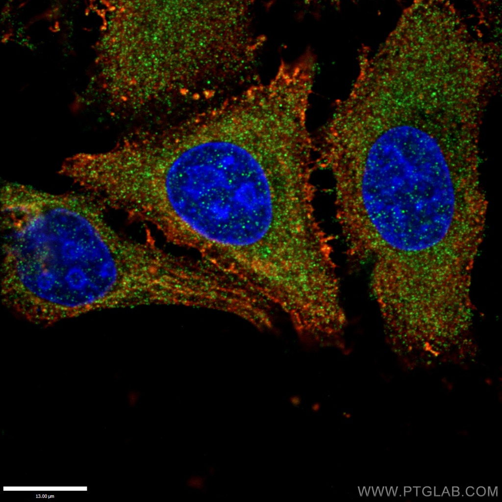 RAB11A/B Polyclonal antibody