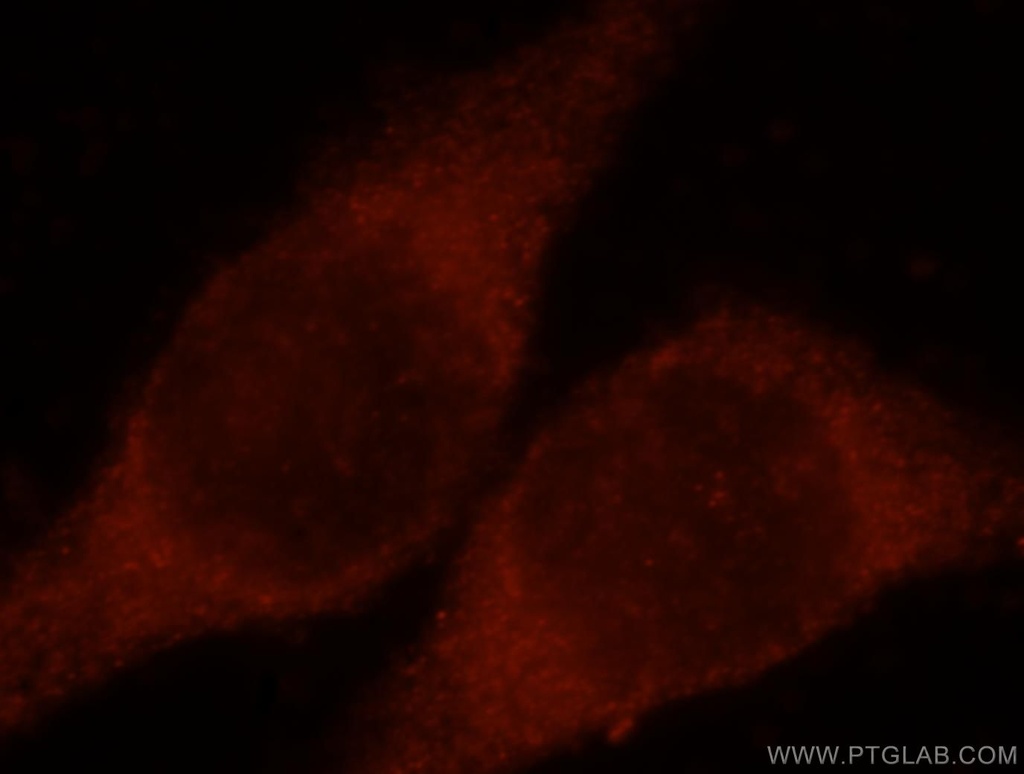 CLIC3 Polyclonal antibody