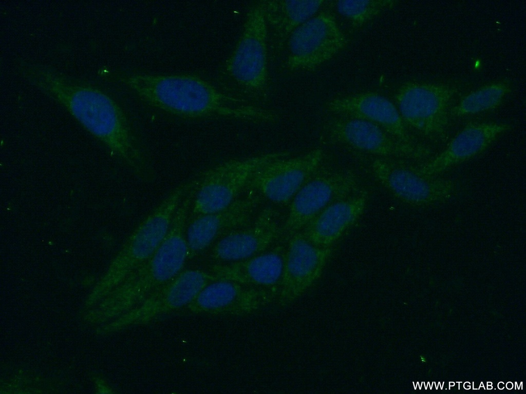 PPP1R8 Polyclonal antibody