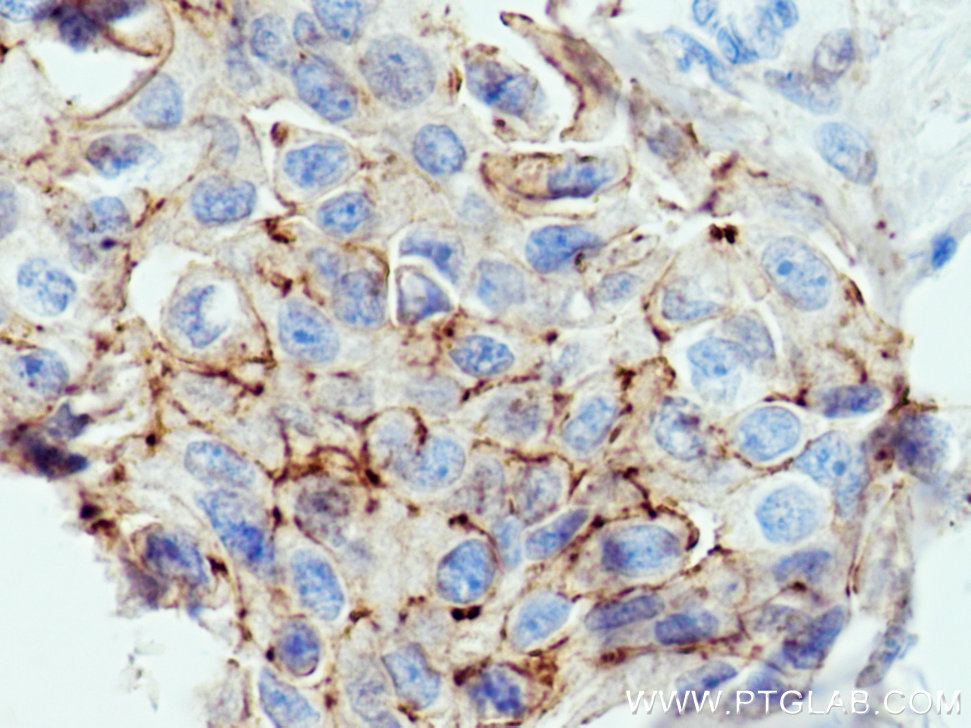 F11R Polyclonal antibody