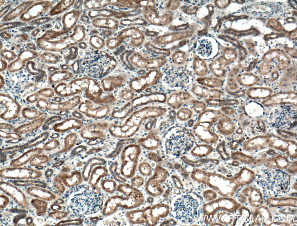 PLEKHM1 Polyclonal antibody