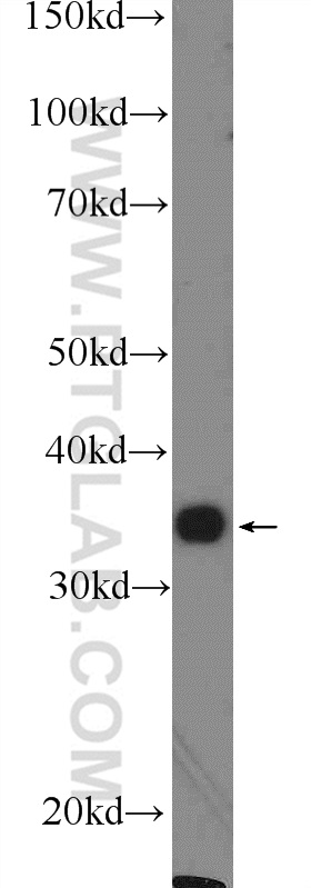 FOXS1 Polyclonal antibody