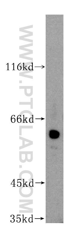 GAL3ST4 Polyclonal antibody