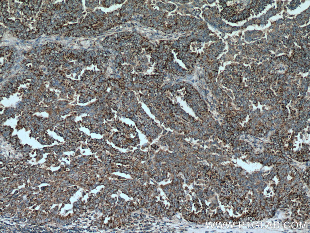 GADD45GIP1 Polyclonal antibody