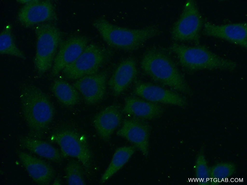 PSG11 Polyclonal antibody