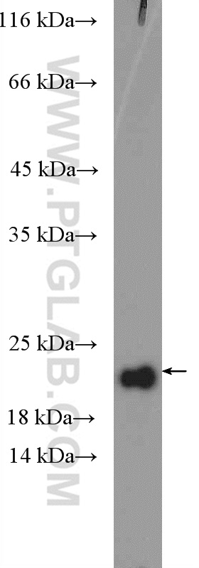 RPP21 Polyclonal antibody