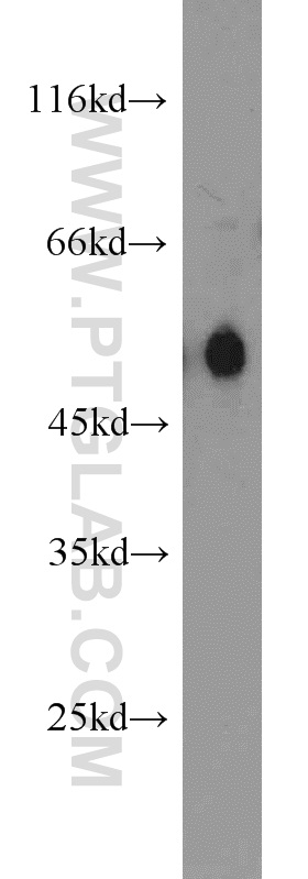 Carboxypeptidase M Polyclonal antibody