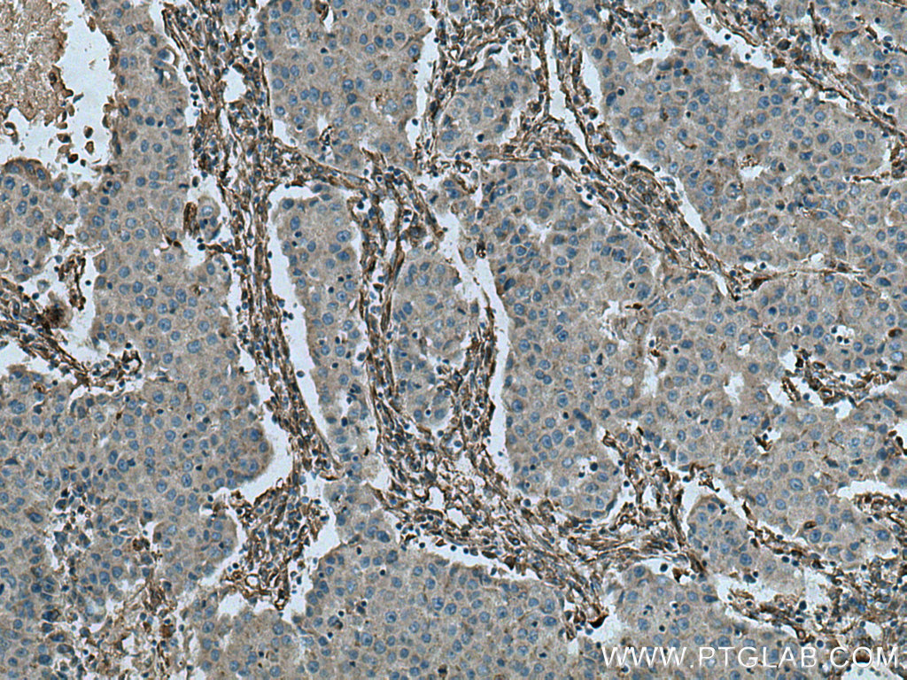 Caveolin-1 Polyclonal antibody