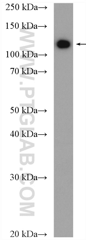 AP3D1 Polyclonal antibody