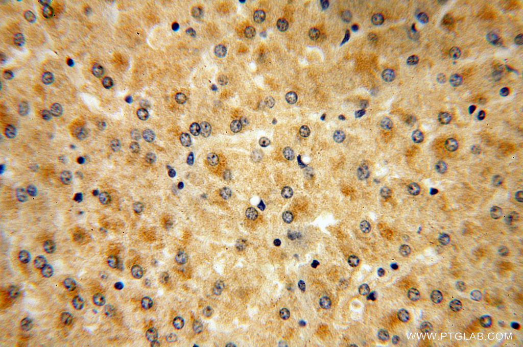 PALMD Polyclonal antibody