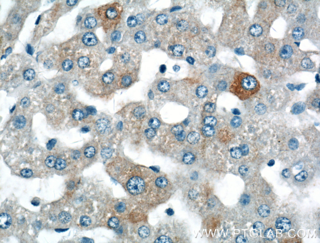 SPG11 Polyclonal antibody