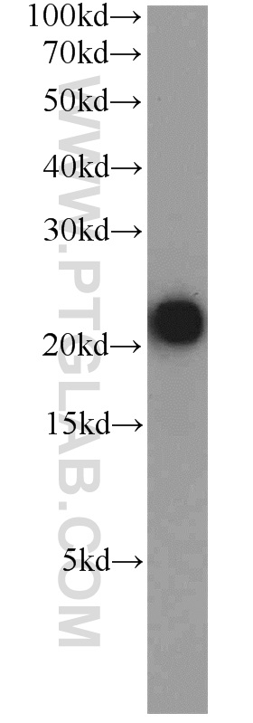 TMEM11 Polyclonal antibody