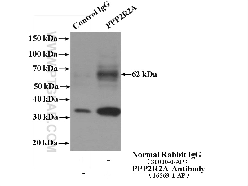 PPP2R2A Polyclonal antibody