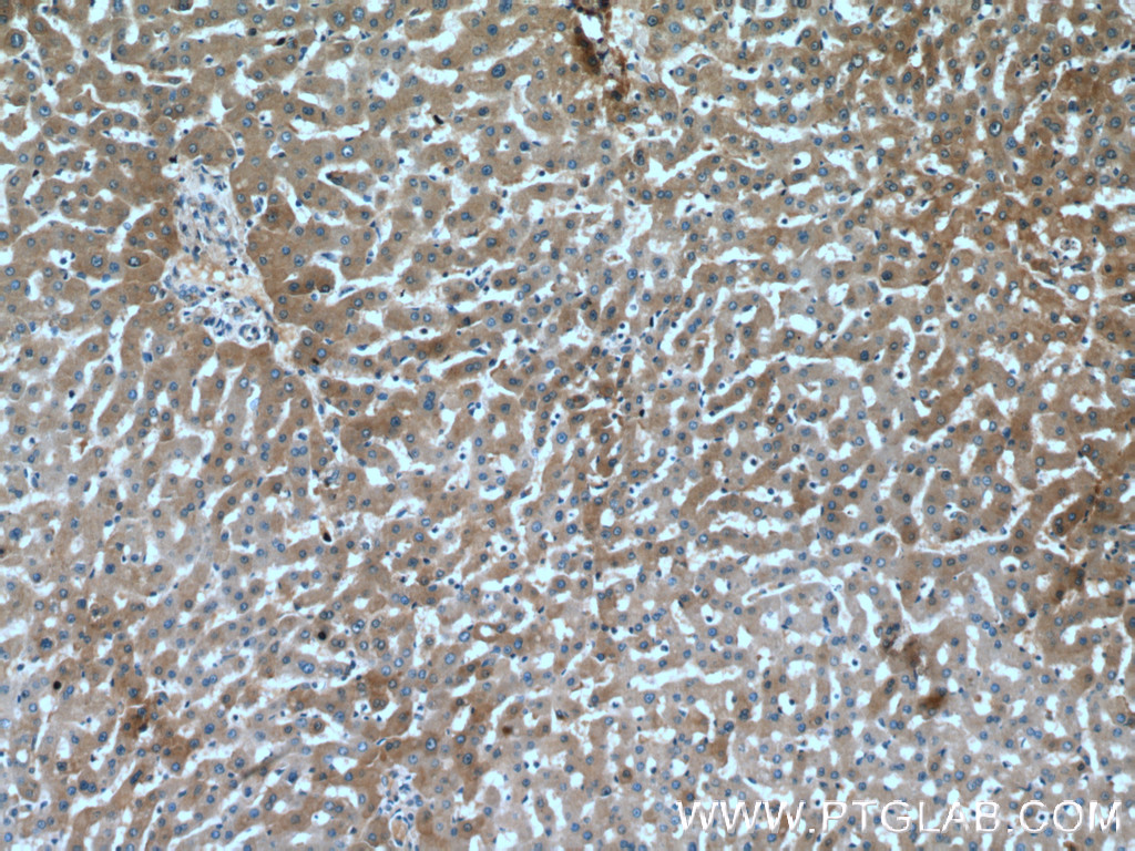 Fetuin-A Polyclonal antibody