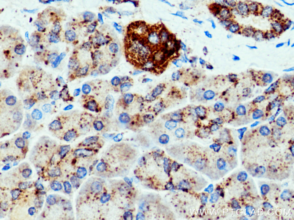 CTSZ Polyclonal antibody