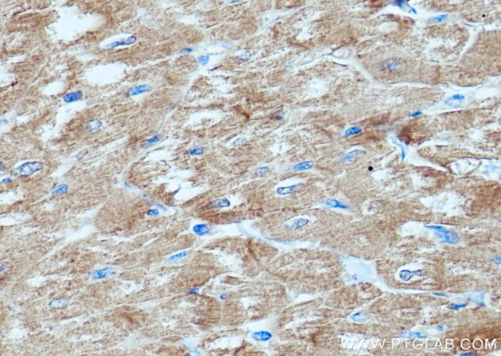AGL Polyclonal antibody