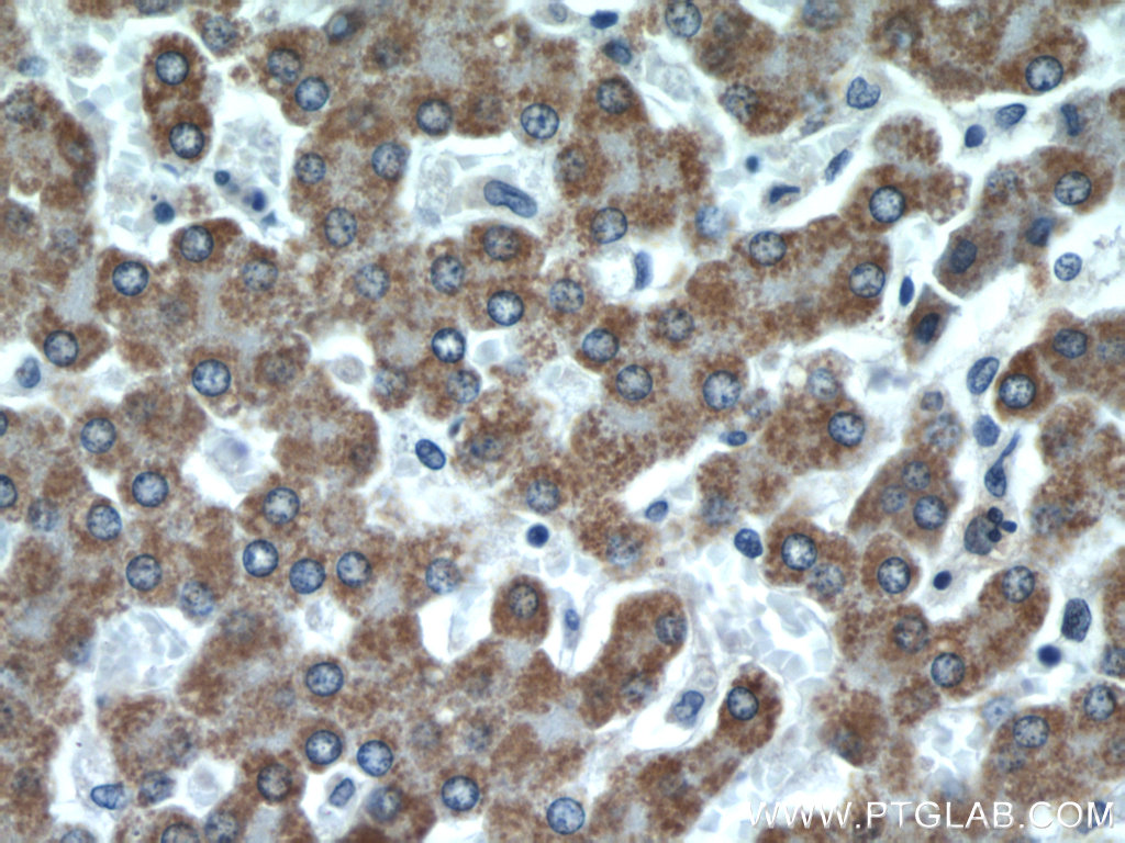 CFHR3 Polyclonal antibody