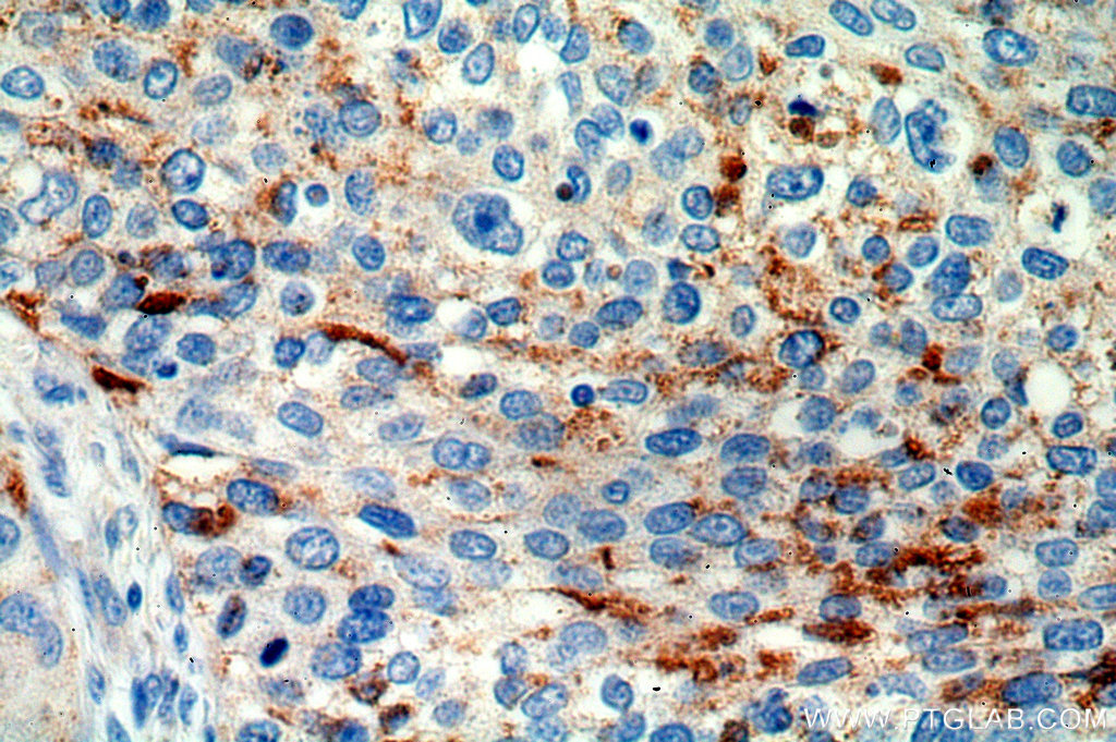 MRPL3 Polyclonal antibody