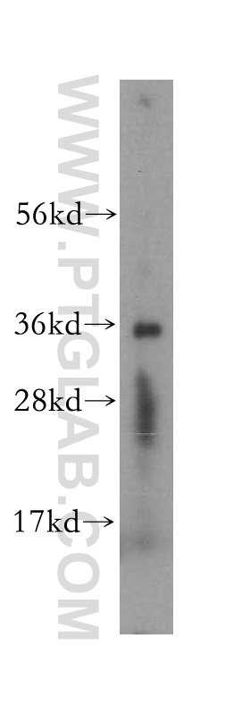 SDR39U1 Polyclonal antibody