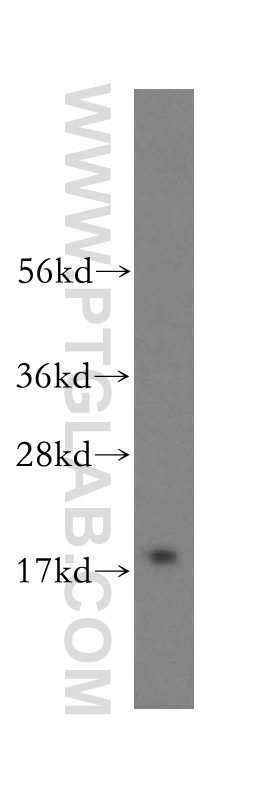 ZNHIT1 Polyclonal antibody