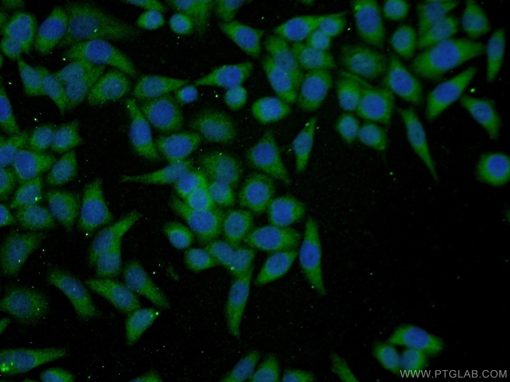 PGCP Polyclonal antibody
