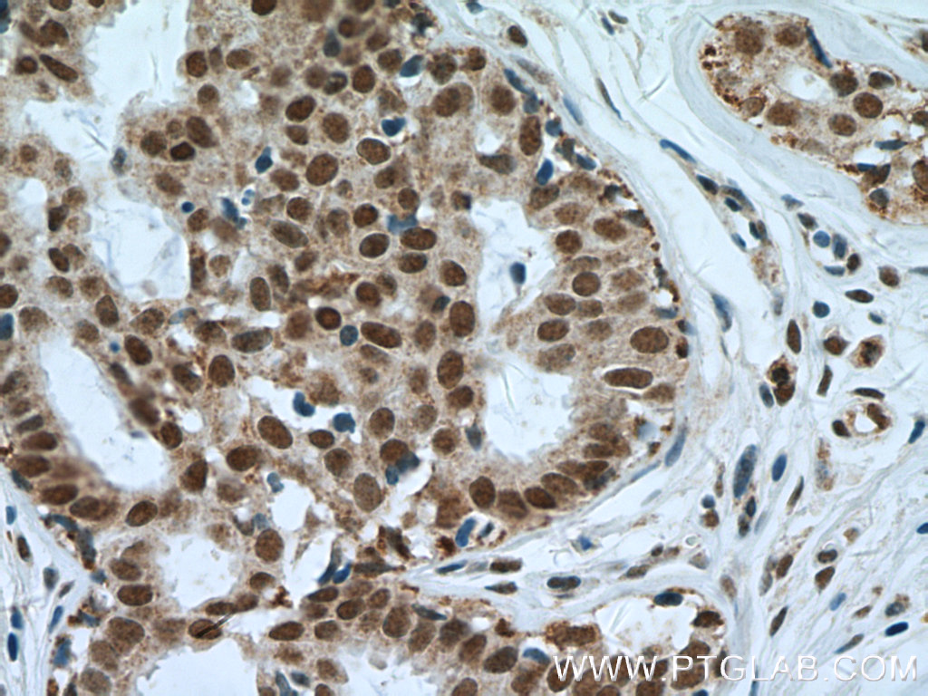 NuMA Polyclonal antibody