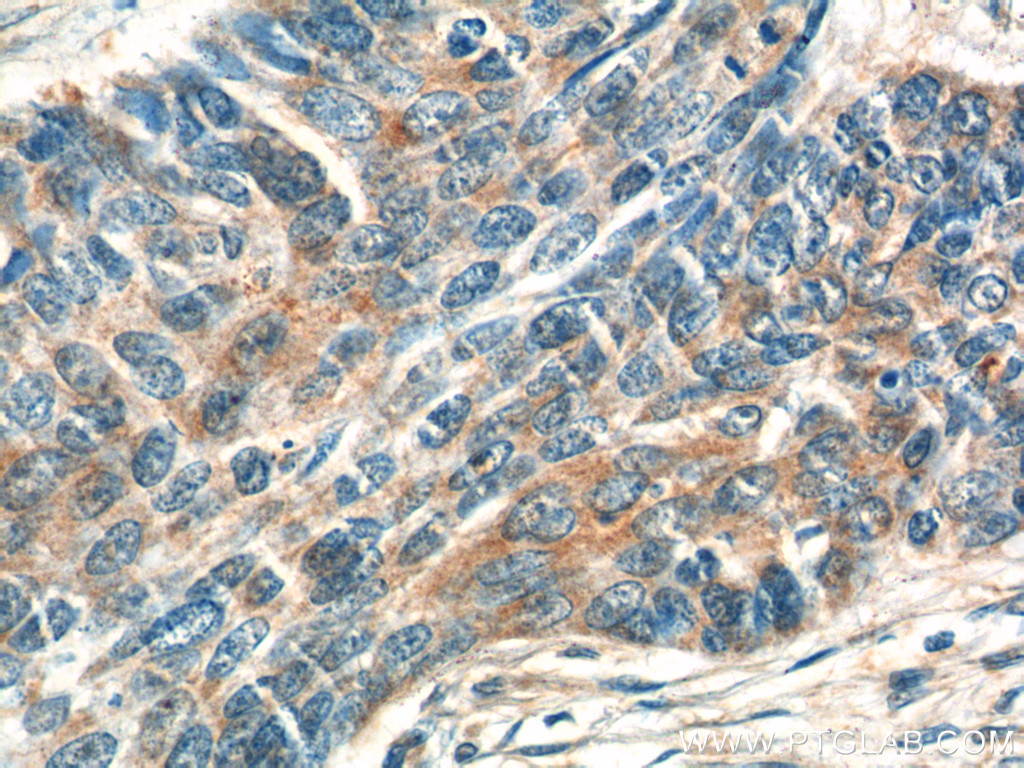 ATAD3A/B Polyclonal antibody