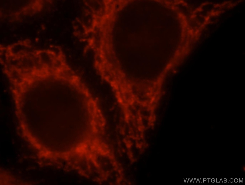 BCL2L13 Polyclonal antibody