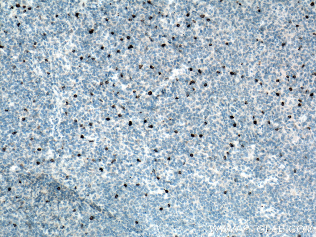 LAG-3 Polyclonal antibody