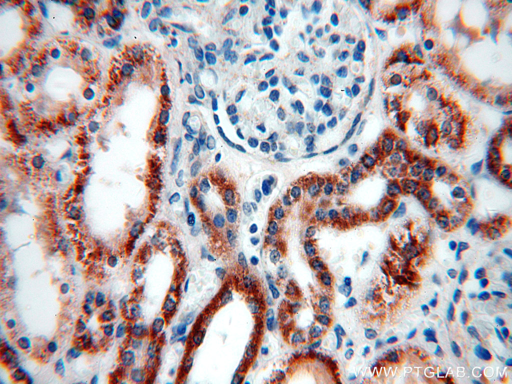 ACADS Polyclonal antibody