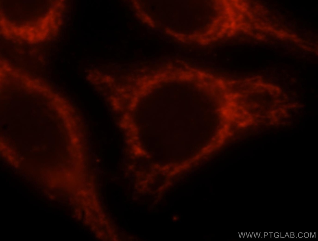 OCIAD1 Polyclonal antibody