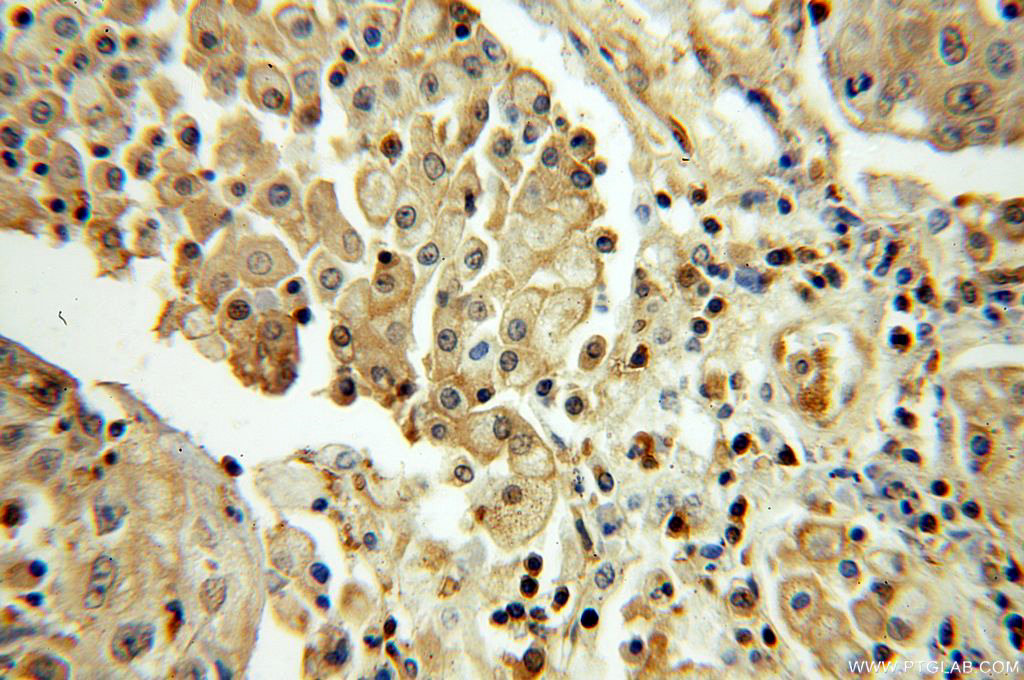 SEPHS1 Polyclonal antibody