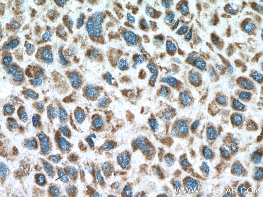 PPA2 Polyclonal antibody