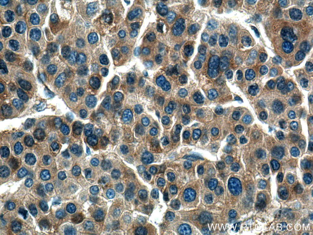 Haptoglobin Polyclonal antibody