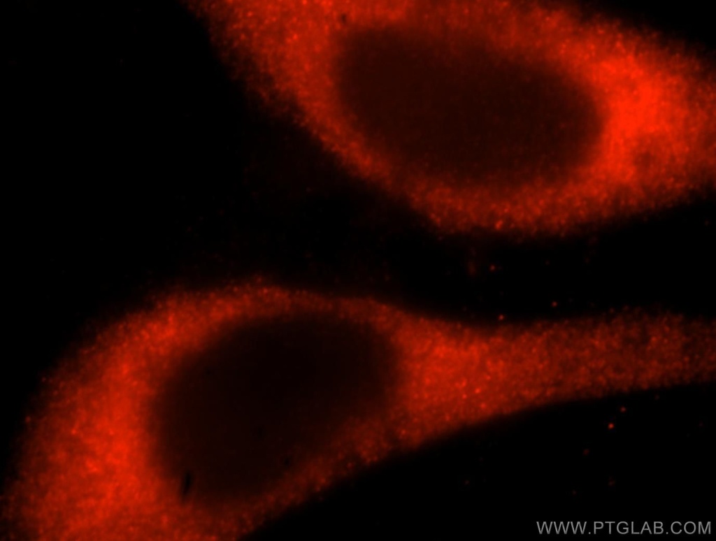 RPS14 Polyclonal antibody