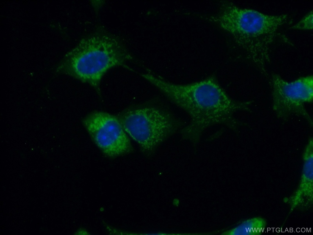 CA13 Polyclonal antibody