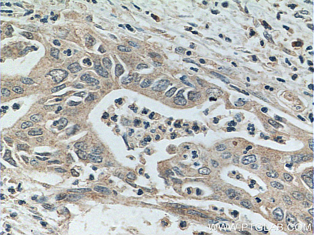 Glypican 1 Polyclonal antibody