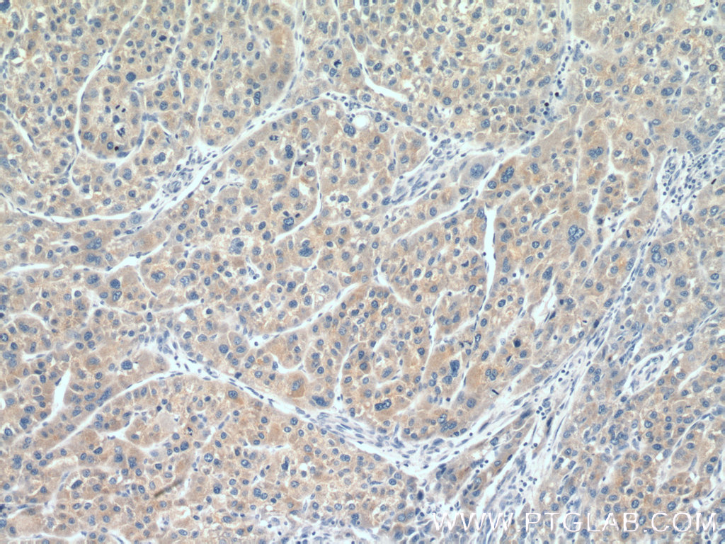 CYP20A1 Polyclonal antibody