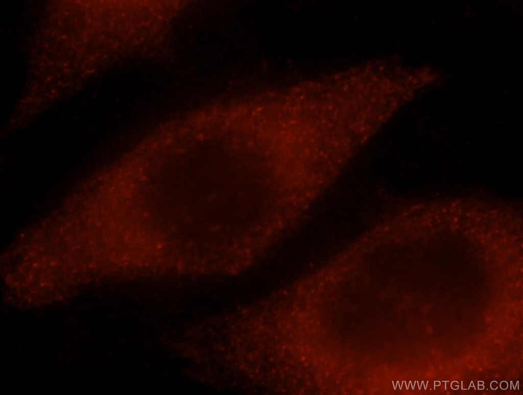 NPL Polyclonal antibody